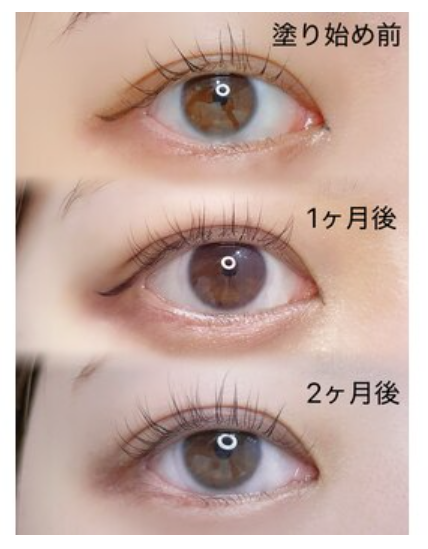 経過観察①