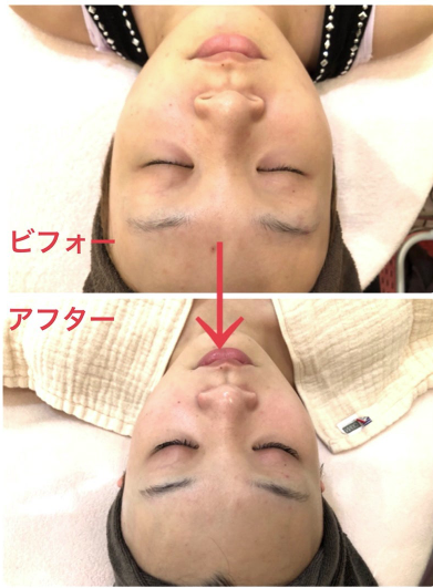 口コミ③