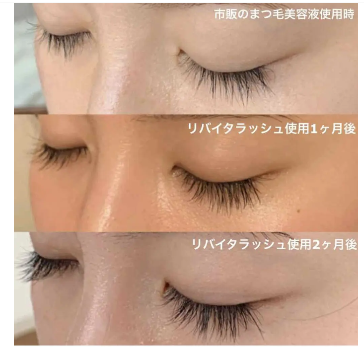 色素沈着のリスクは？➁