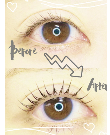 実際の施術体験レポート