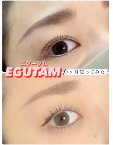 ビフォーアフター①