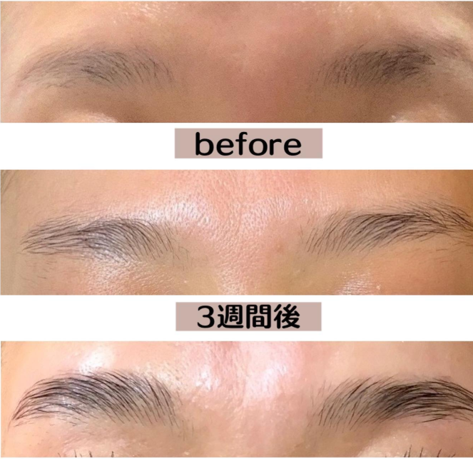 生やす方法:眉毛美容液で効果を実感した人の声